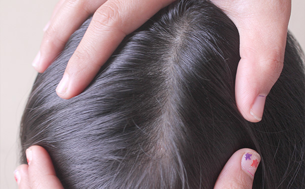Head Lice – Symptoms, Causes, Treatment and Prevention